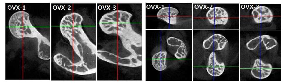 난소를 전절제한 골다공증 마우스 대퇴골두에서의 Micro-CT결과