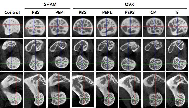 난소를 전절제한 골다공증 마우스에 C3펩타이드 처리 2개월 후 대퇴골두에서의 Micro-CT결과