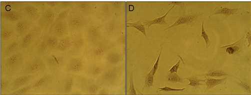 골조직으로의 분화에 의해 침착된 Calcium phosphate의 염색 (C: Control cell, D: Differentiated cell)