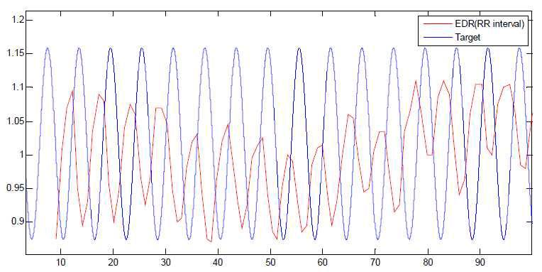 RR intercal을 이용한 ERD 신호화 호흡유도 신호.