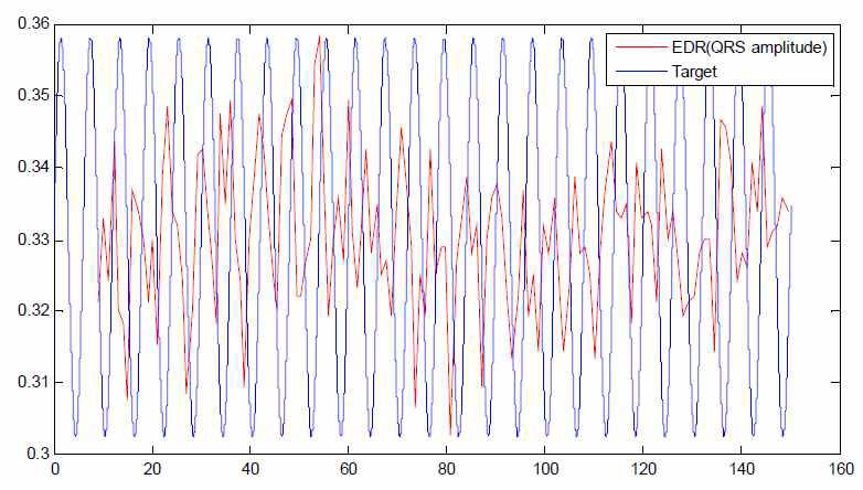 QRS amplitude를 이용한 EDR 신호와 호흡 유도 신호