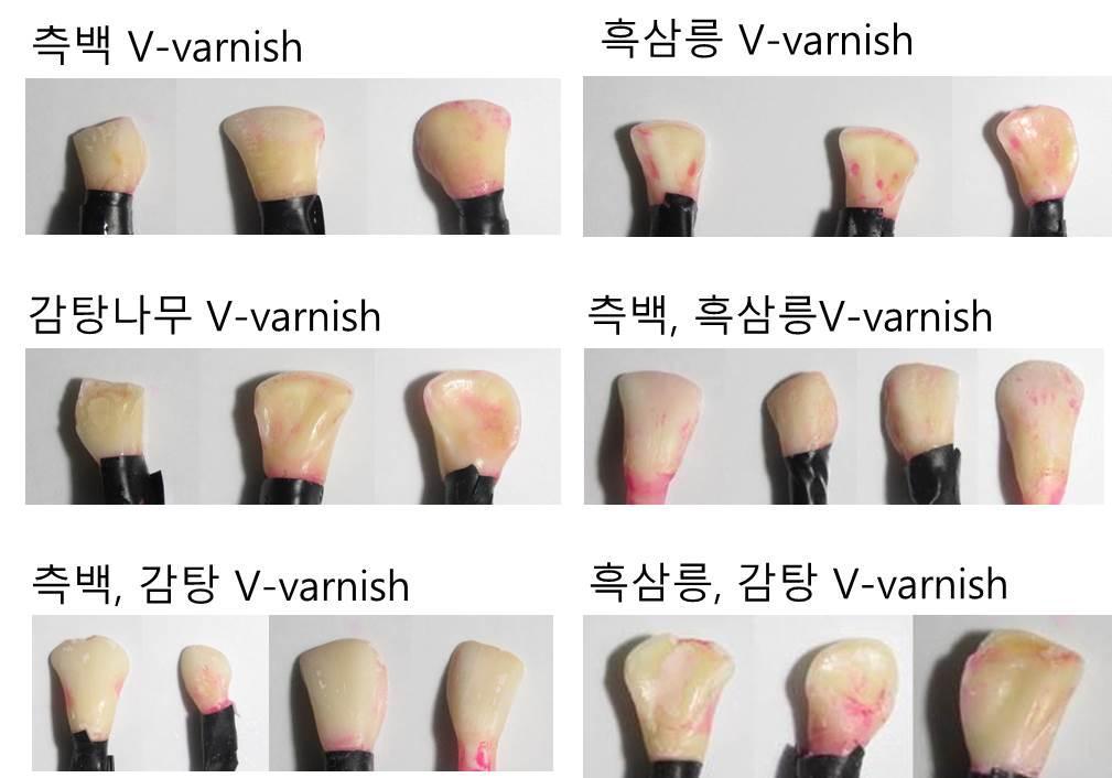 천연물 추출물을 포함한 V-varnish Premium의 생물막 억제 효능 확인