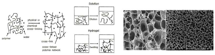 하이드로겔의 모식도 및 현미경 사진