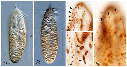 Bakuella (Bakuella) n. sp. 2는 몸 크기 72–106 × 20–40 μm이고, 원통형의 몸이 유연하고 약간 수축성이 있다. 노란색의 표층과립이 있으며, 21–25개의 입주변겹섬모막, 3개의 큰 전방극모, 1 구극모, 1parabuccal, 3–4 전방말단극모, 보통 1개의 전방횡복극모, 4–5 횡극모를 가지며, 중앙복극모복합체가 7–10 중앙복극모쌍과 1–2 중앙복극모열로 이루어져있다. 각각 1열의 좌,우측극모열을 가지며, 3열의 등쪽섬모열, 58–87개의 대핵, 3–6개의 소핵을 가지고 있다. Bakuella (Bakuella) incheonensis n. sp.의 생체 사진(A–B)과 프로타골 염색 사진(C–E).