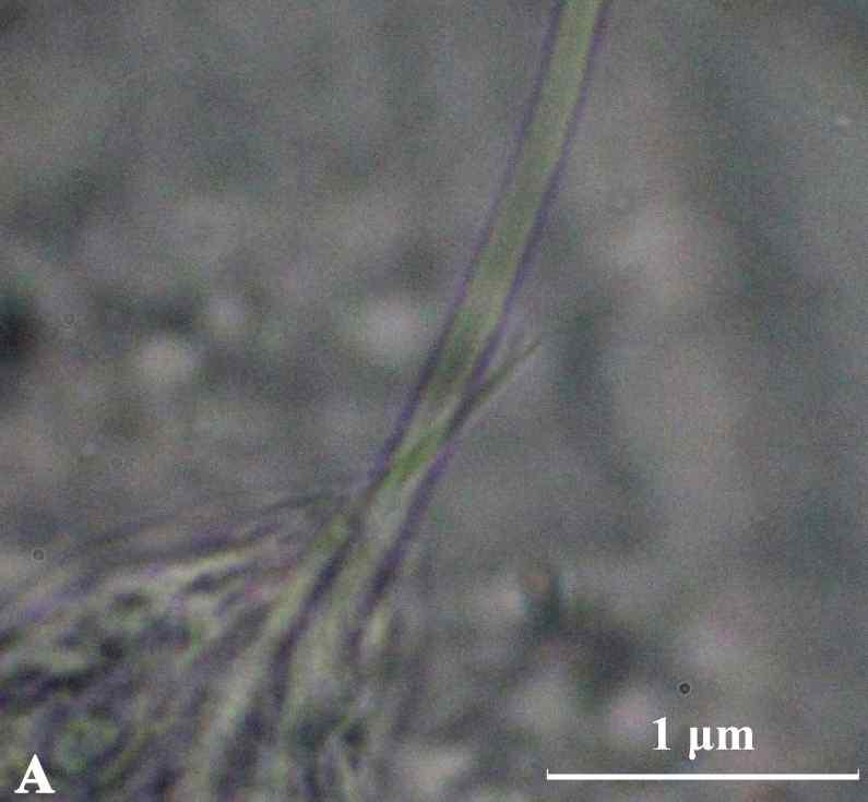 Pristina n. sp.는 dorsal chaeataes는 가늘고 표면이 매끈한 hair chaetae를 1-2개를 가지며, 1-2개의 끝이 두 갈래로 갈라진 needle을 가진다. ventral chaetae는 5-6개가 1 묶음으로 끝이 두 갈래로 갈라져있다. upper tooth는 lower tooth 보다 가늘다. Pristina n. sp.의 염색슬라이드 사진