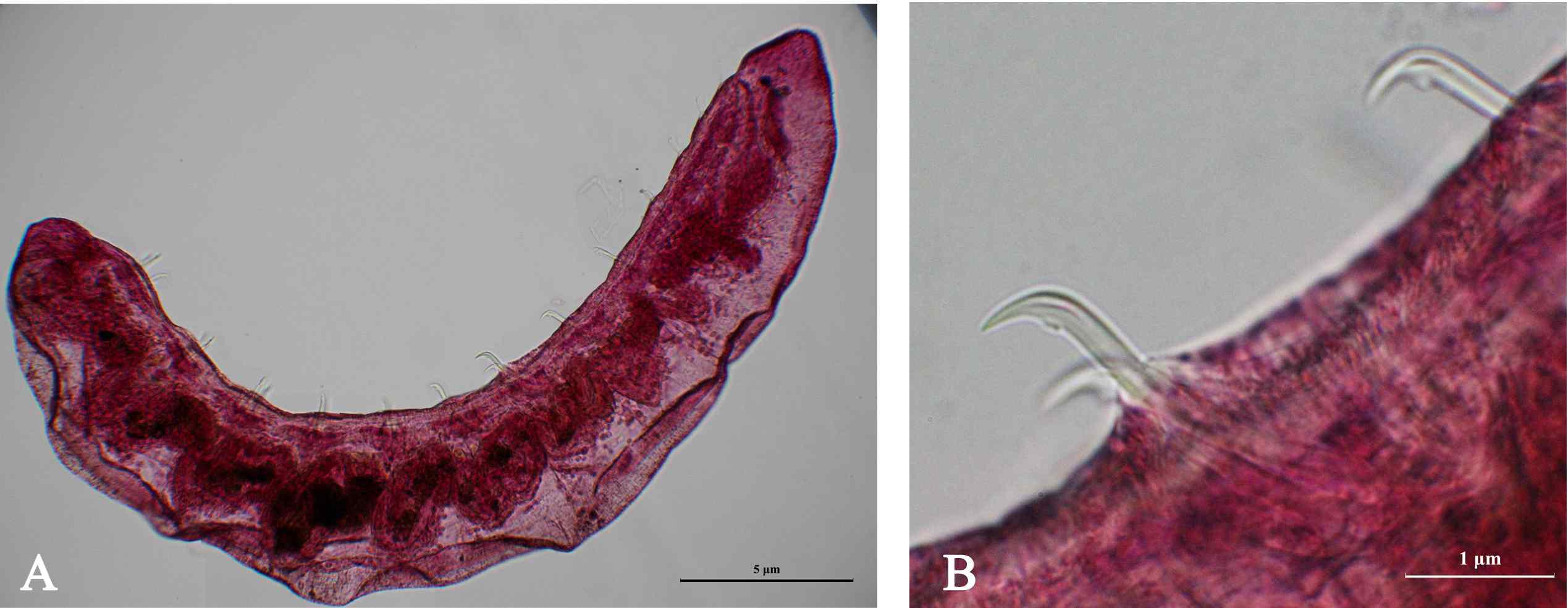 Nais bretscheri Michaelsen, 1899는 2-7개씩 묶음으로 되어있는 ventral chaetae를 가지는데 upper tooth의 길이가 lower tooth의 길이보다 약 2배이상 길다. 또한 giant chaetae를 가지는데, 이 chaetae 는 7번째 체절부터 시작이 되고 2개씩 존재하며 다른 복면chaetae에 비해 두껍고 곧게 뻗어있으며 길이는 매우 짧다. Hair chaetae는 한 개씩 가지며 짧고 1-2개의 needle를 가지며 매우 짧고 갈라진 길이는 같다. Nais bretscheri Michaelsen, 1899의 염색 슬라이드 사진