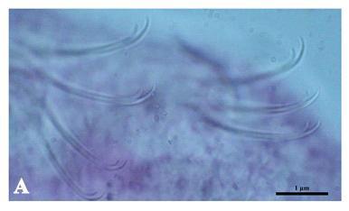 Nais simplex Piguet, 1906는 Dorsal hair chaetae와 needles이 1-2개씩 묶음으로 있고, needles의 끝은 끝이 뾰족하다. 두 번째 체절부터 5번째 체절의Ventral chaetae는 2-6씩 묶음으로 되어있으며 upper tooth의 길이가 lower tooth에 비해 더 얇고 두 배 정도 길며 직선으로 뻗어있다. Nais simplex Piguet, 1906 염색 슬라이드 사진