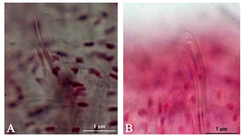 Nais stolci Hrabe, 1981는 2번째부터 5번째 체절에 존재하는 ventral chaetae는 3-5가 한 묶음이며 upper tooth가 lower tooth에 비해 2 배정도 길고 더 두껍다. 6번째 체절부터 ventral chaetaes는 넓게 벌어진 2-3를 묶음으로 가진다. Upper tooth는 lower tooth보다 약 4 배 정도 길다. 등쪽에는 1개의 hair chaeta와 끝 길이가 같은 1개의 needle chaeta를 가진다