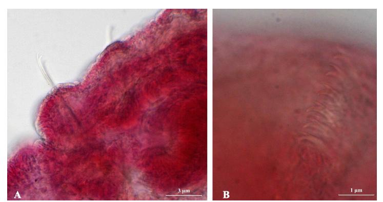 Paranais orientalis (Sokolskaja, 1964)의 두 번째 체절의 ventral chaetae는 4-7가 한 묶음으로 가진다. Dorsal chaetae는 5번째 체절부터 시작되어지고 5-6가 한 묶음으로 되어있다. 몸의 끝으로 갈수록 ventral and dorsal bundles은 2-4 chaetae로 되어있다. Teeth의 길이는 몸의 끝으로 갈수록 두 길이가 같아지고 짧아진다. Paranais orientalis (Sokolskaja, 1964)의 염색슬라이드 사진