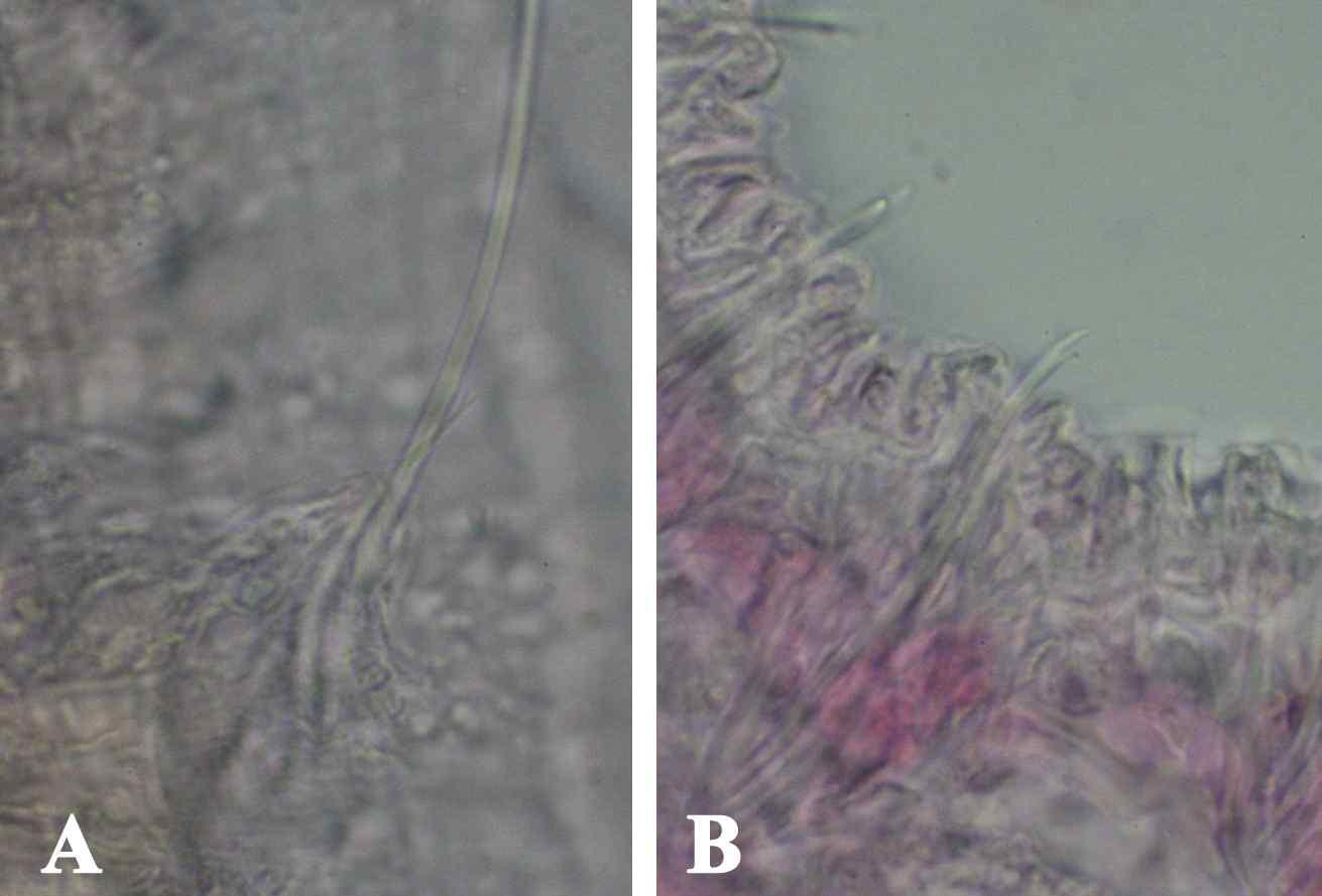 Pristina breviseta Bourne, 1891는 Hair와 needle chaetae를 1나씩 가진다. Needle의 끝은 구브러져있고 Tooth 길이는 같다. Upper tooth는 몸의 뒤편으로 갈수록 lower tooth보다 더 얇아지고 짧아진다. Ventral chaetae 는 한 묶음 당 3-5개가 있으며, upper tooth는 lower tooth보다 길다. Pristina breviseta Bourne, 1891 염색 슬라이드 사진.