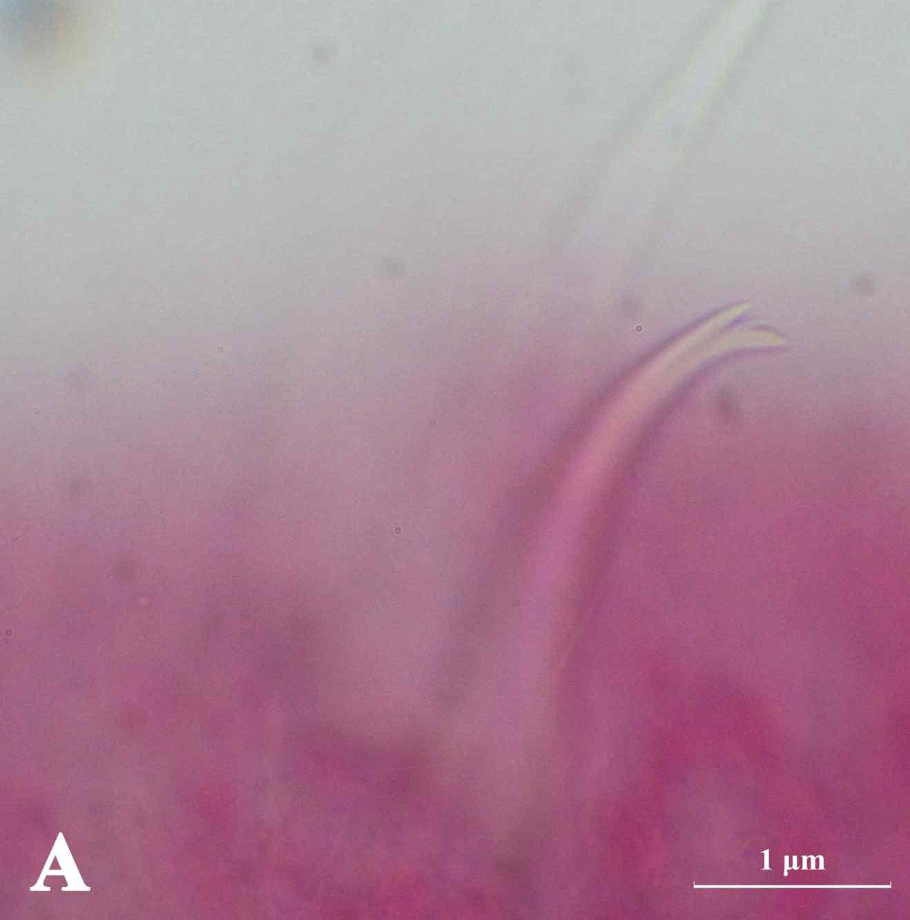 Aulodrilus pluriseta (Piquet, 1906)는 몸의 앞쪽의 drosal bundles 2-3 hair chaetae 와 3-4 bifid crotchet를 가진다. 몸의 앞쪽의 ventral 한 묶음 당 4-5 crotchet를 가지며, crotchets의 lower tooth가 upper tooth보다 두껍고 더 길며 표면은 매끄럽지 않으며 작은 tooth가 존재한다. Aulodrilus pluriseta (Piquet, 1906)의 염색 슬라이드 사진