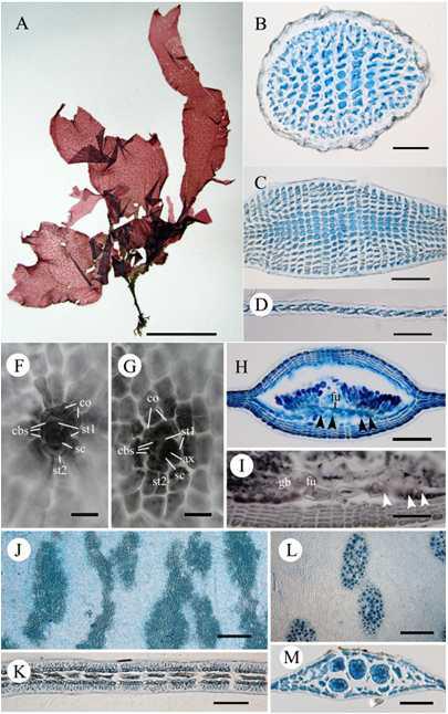 우도새엷은잎 (Neoharaldiophyllum udoensis)의 영양체 및 생식기관의 구조.