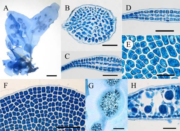 Schizoseris subdichotoma var. minima var. et comb. nov.의 영양체 및 사분포자체의 형태