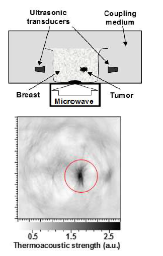 유방암 조직의 열음향 영상