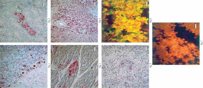 백신이 투여되지 않은 조류의 Immunohistochemistry 결과