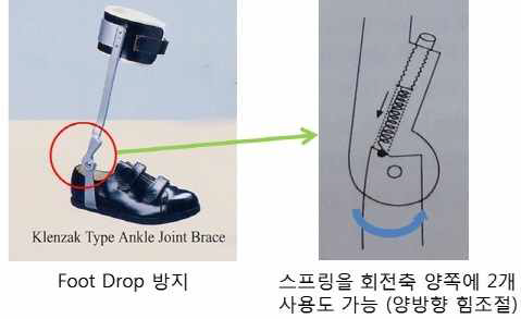 Klenzak Joint 사용 예