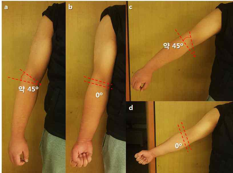 인체 위한 외골격 3축 교정기 예상도