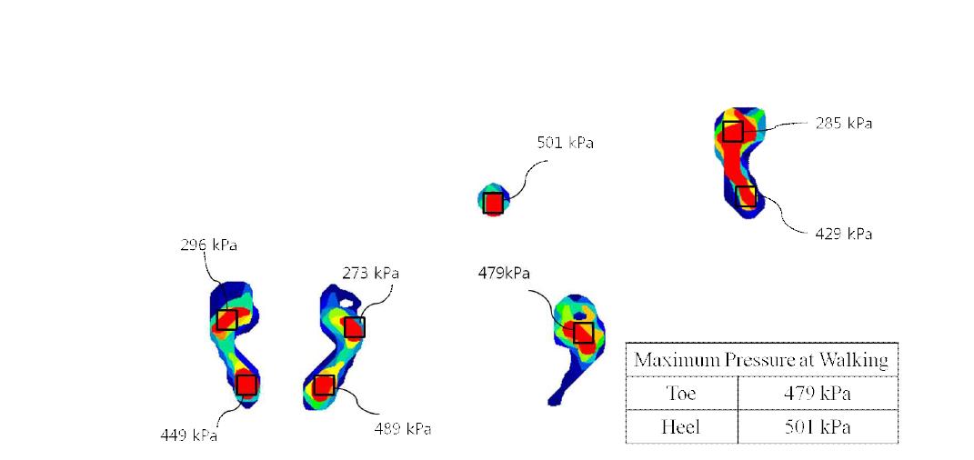 Measurement of Foot Pressure using BPMS