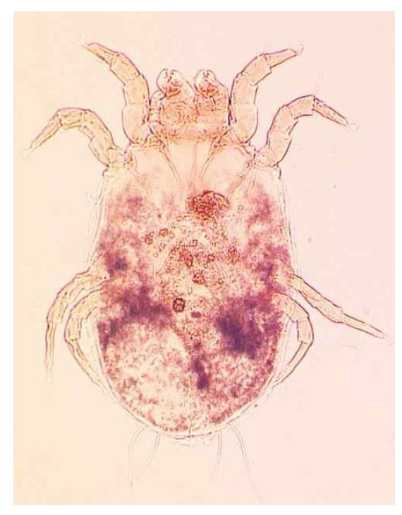 큰다리먼지진드기(Dermatophagoides farinae)