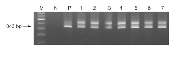 SFTSV Nested PCR 결과