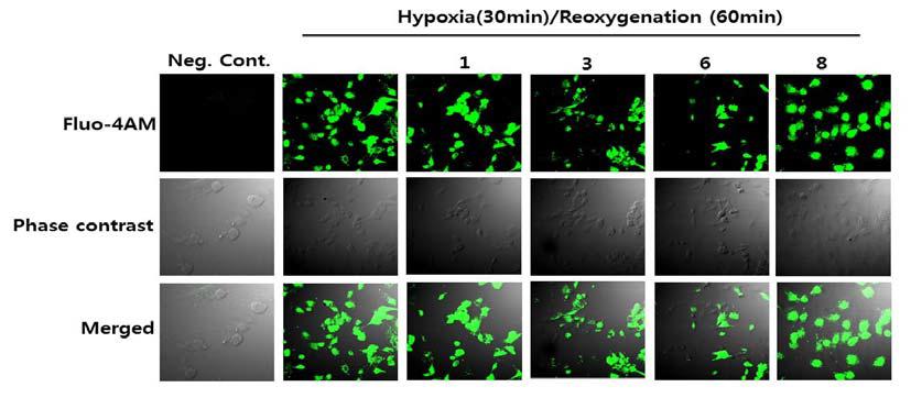 Effects of extract from D. morbifera on intracellular Ca2+ levels in H/R-injured cardiomyocytes