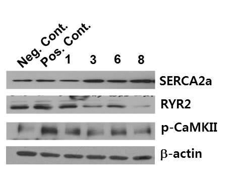 Effects of extract from D. morbifera on Ca2+-related proteins in H/R-injured cardiomyocytes