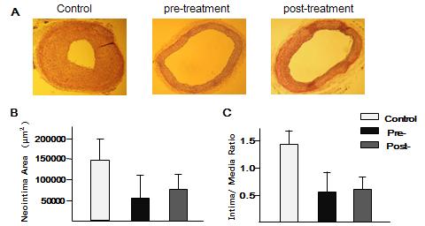 Extract of Dendropanax inhibits neointimal formation