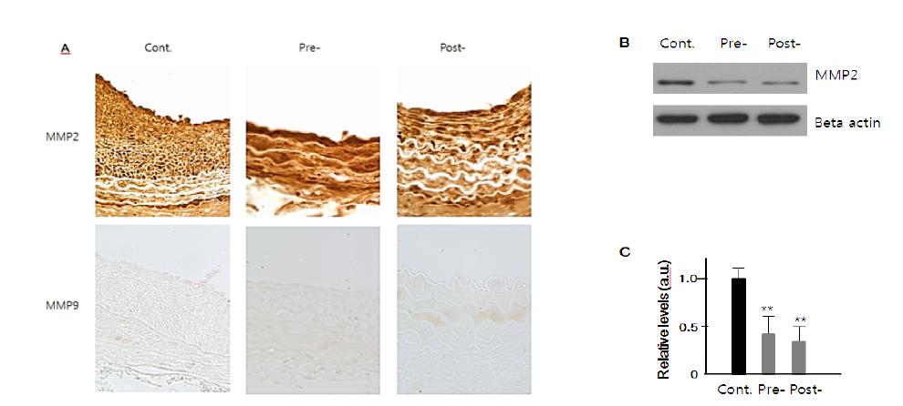 Extract of Dendropanax suppresses SMC migration