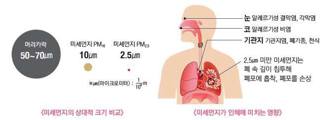 미세먼지의 크기와 알레르기 질환에 미치는 영향