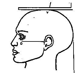 Frankfort Plane for Measuring Body Height