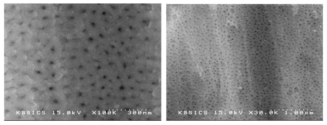 양극산화 시 전압 40V, 40분 처리한 전자현미경 사진
