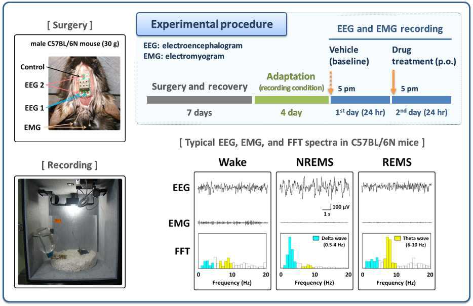 Experimental protocol for EEG (Electroencephalogram) and EMG (Electromyogram) recording in mice