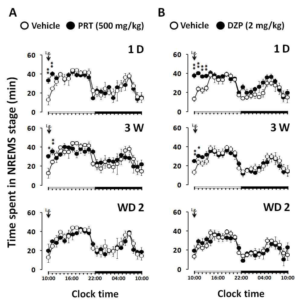 Time courses of NREMS after repeated administration of PRT and DZP in C57BL/6N mice