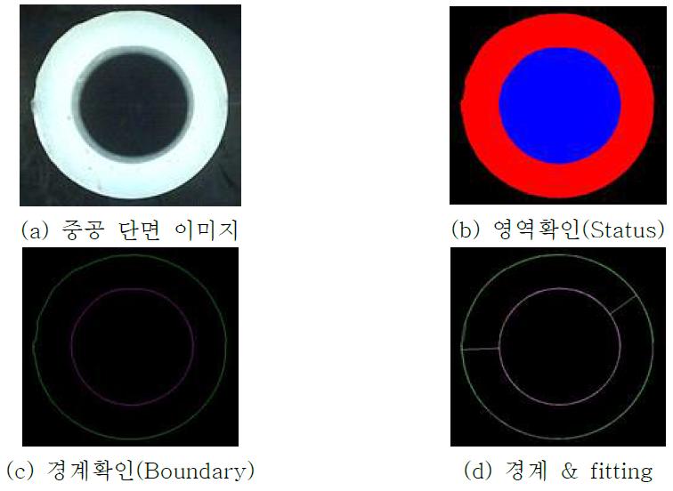 중공부 잔류벽의 자동 영역 인식