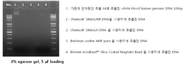 Agarose gel 전기영동 결과