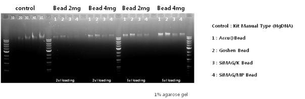 B사와 Goshen사의 핵산 추출 비교 agarose gel 전기영동 결과