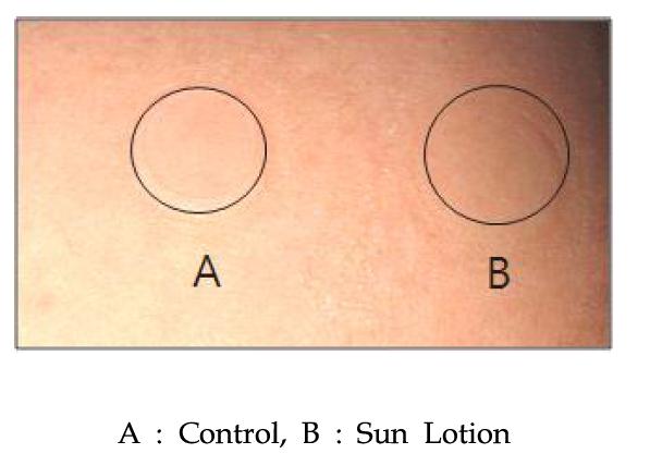 Patch test 실험결과