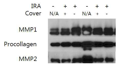 약 360J/cm2의 IR-A를 24시간 동안 조사한 후 Human primary fibroblast cell의 MMP1, MMP2, 및 Procollagen의 Western blotting 결과