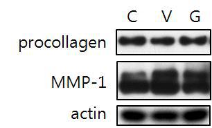 IR-A를 30분(640J/cm2) 동안 조사한 후 Human primary fibroblast cell의 Procollagen, MMP-1, 및 Actin의 Western blotting 변화