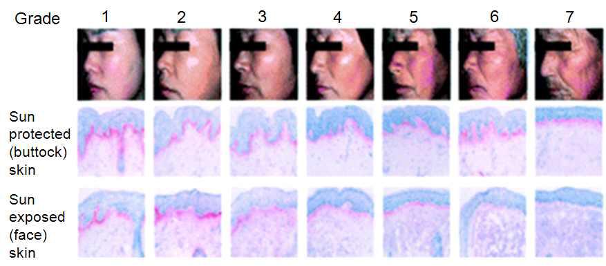 1 ~ 7등급의 피부를 갖는 한국인들의 얼굴 사진 및 엉덩이 피부조직과 얼굴 피부조직의 현미경 사진
