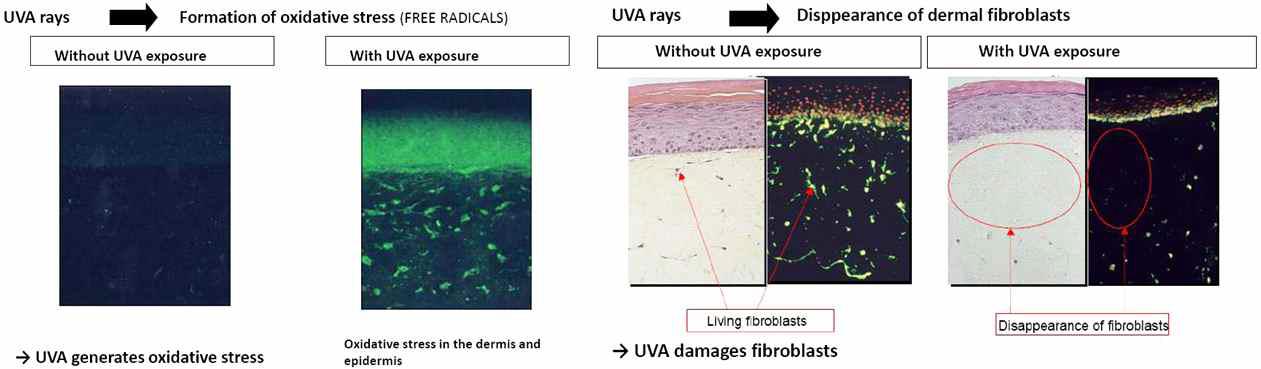 UV-A에 의한 피부 속 활성산소의 증가와 섬유모세포의 사멸