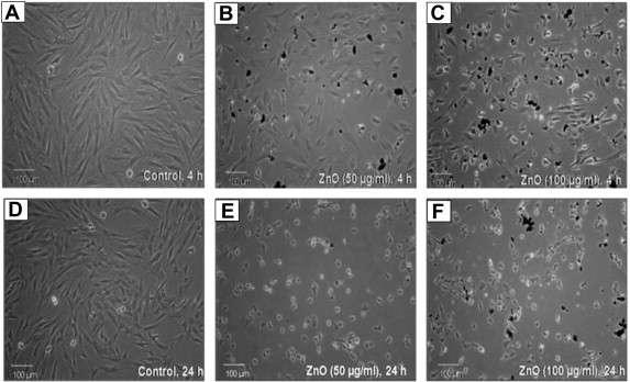 50, 100μg/mL의 ZnO 농도로 처리한 피부 섬유화 세포의 시간에 따른 세포파괴 현미경 사진