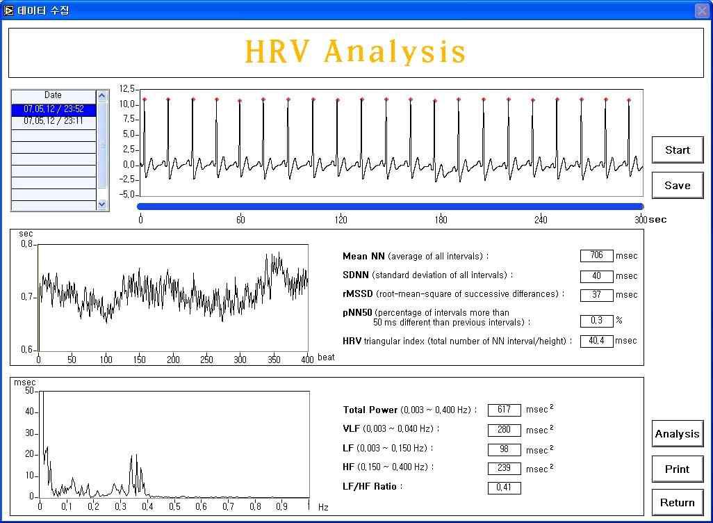심전변이도(HRV) 분석 프로그램
