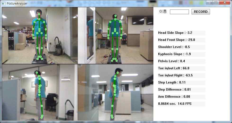Kinect 활용 보행 분석 화면