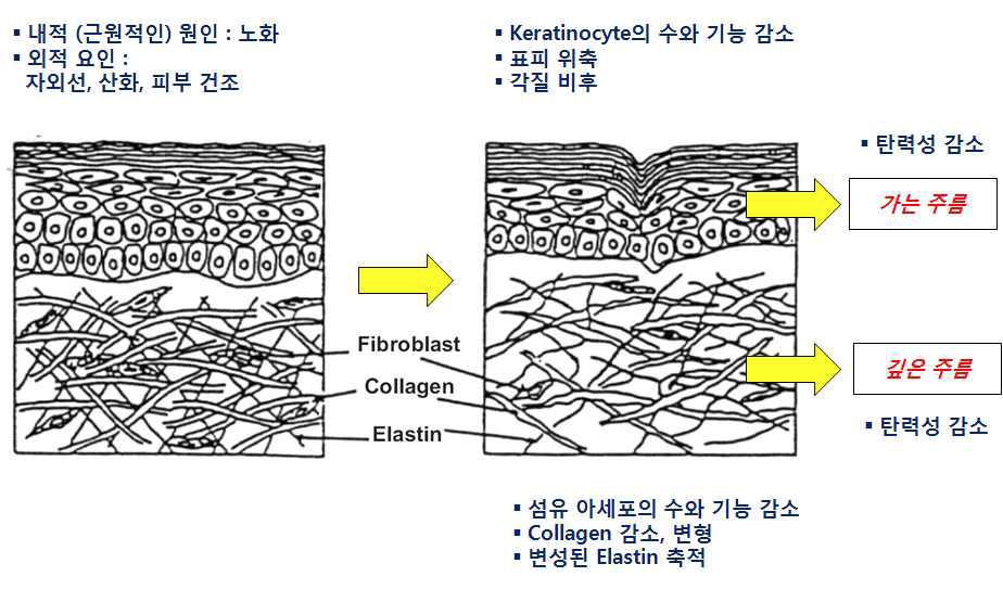 주름 생성원인과 과정