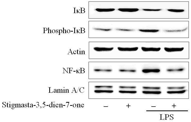 Effect of Stigmasta-3,5-dien-7-one on the expressions of NF-κB and related proteins.