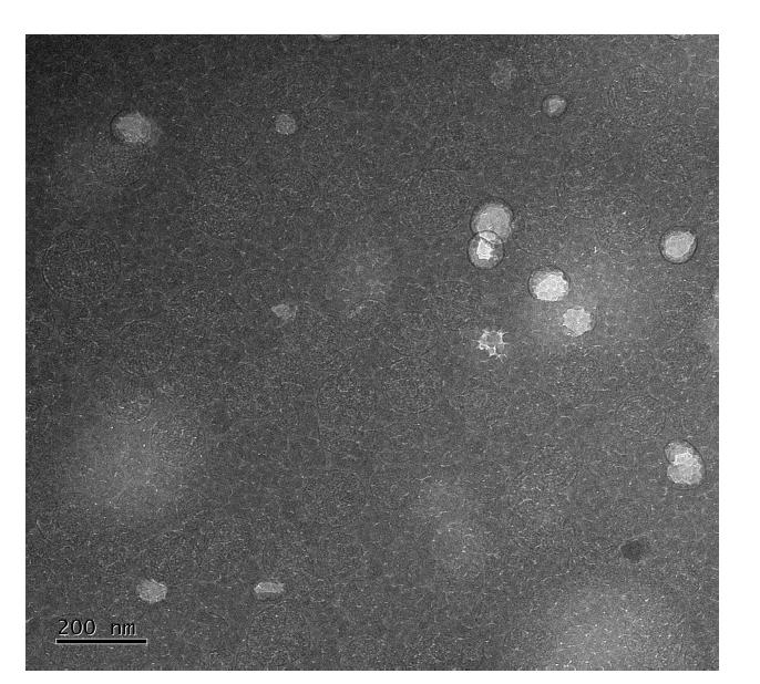 Cryo-TEM images of liposome sample 2.