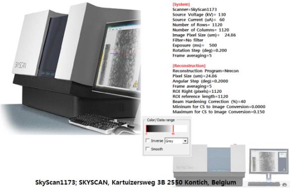 X-ray 촬영에 사용된 SkyScan1174 장비