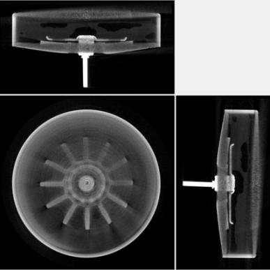 150℃ 저장 후 지지대 장착 셀의 X-ray 촬영 사진.