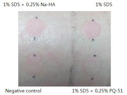 PQ-51의 24시간 패치테스트 피부변화